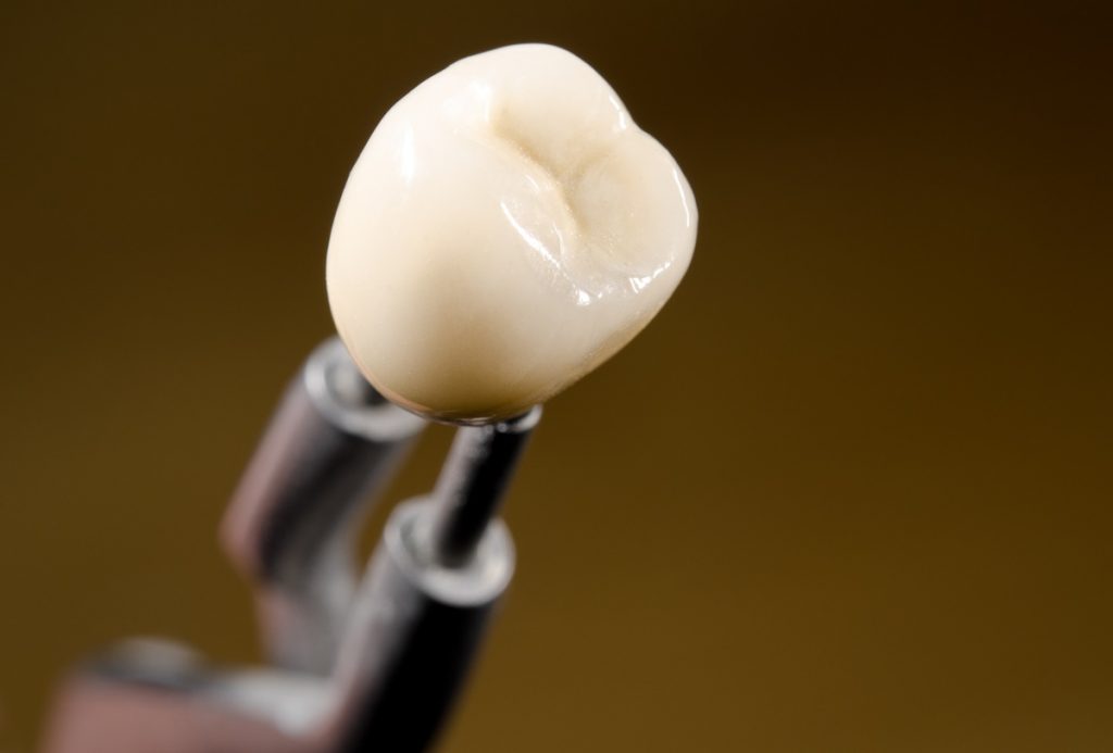 tooth for implant