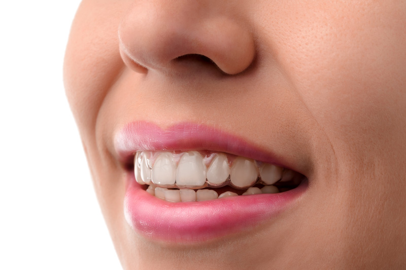 woman showing teeth