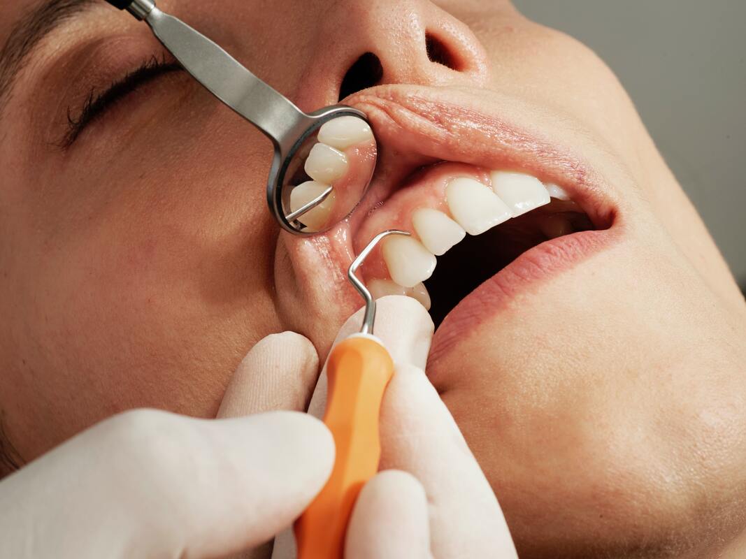 dentist checking a tooth
